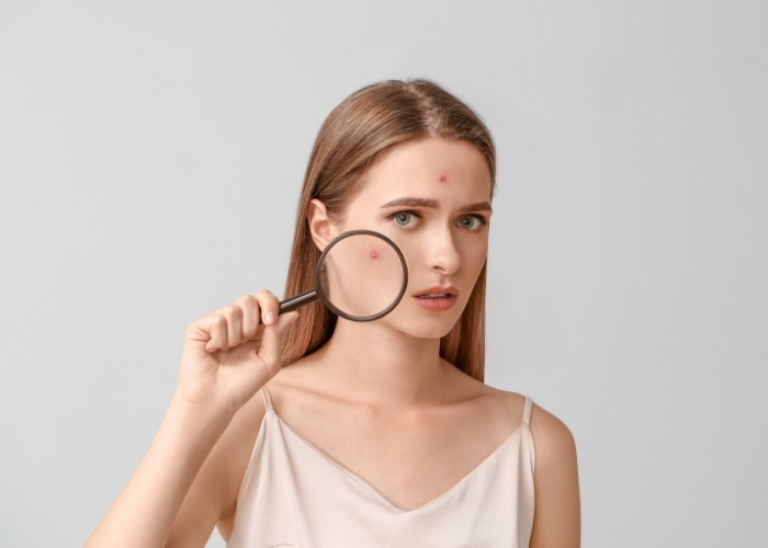 Read more about the article Крем от геморроя от морщин: звёздный секрет или опасный эксперимент? Разбираем отзывы