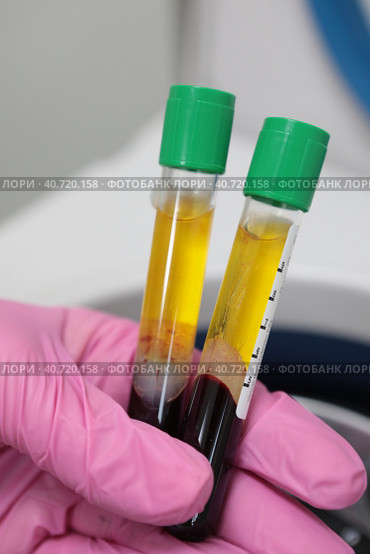 Read more about the article Плазма для волос: честный разбор процедуры, результаты и подводные камни